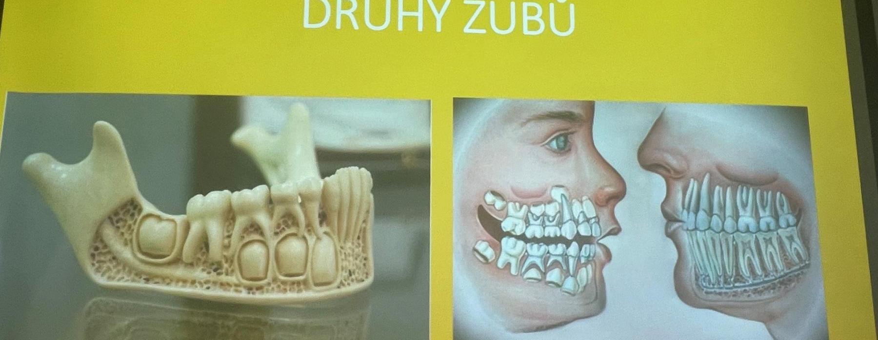 Ročníkový projekt „Zuby a zubní hygiena“ (1.B)