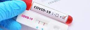 Povinné screeningové antigenní testování na Covid-19 a nabídka kvalitnějších a průkaznějších PCR testů pro naše žáky!